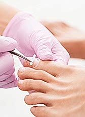 Вросший ноготь: что делать?