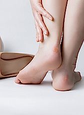 Как избавиться от мозолей и натоптышей