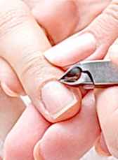 Воспаление ногтя