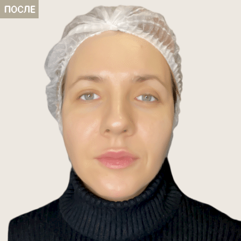 1 после.png