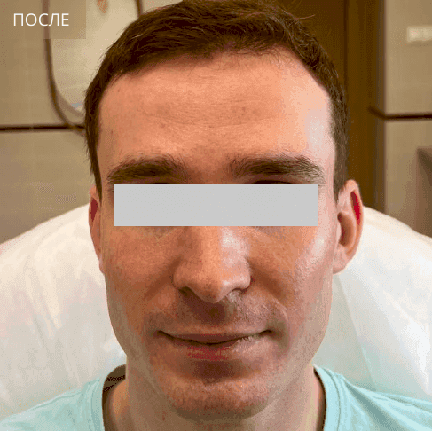 1 после.png