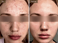 До/После фото 2 - 