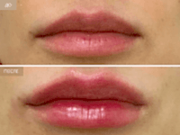 До/После фото 2 - 