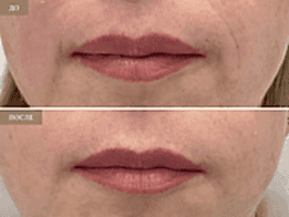 Фотогалерея фото 2 - 