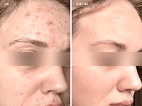 До/После фото 2 - 