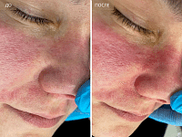 До/После фото 2 - 