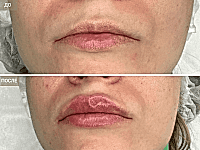 До/После фото 2 - 