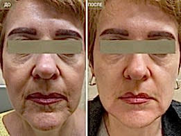 Фотогалерея фото 4 - 