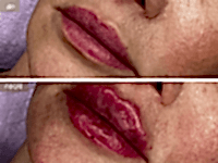 До/После фото 2 - 