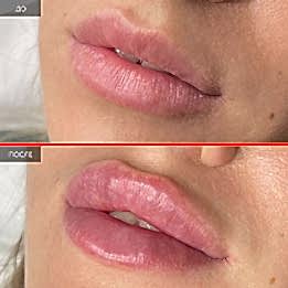 Фотогалерея фото 2 - 