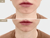 До/После фото 2 - 