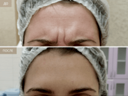 Фотогалерея фото 2 - 