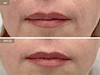 До/После фото 2 - 