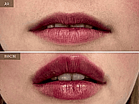 До/После фото 2 - 