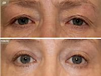 До/После фото 4 - 