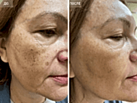 До/После фото 1 - 