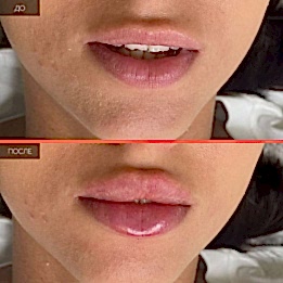 Фотогалерея фото 2 - 