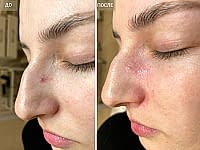 До/После фото 2 - 