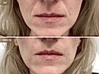 До/После фото 2 - 