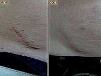 До/После фото 3 - 