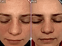 До/После фото 1 - 