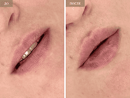 Фотогалерея фото 2 - 