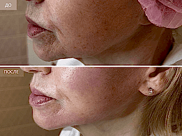 Фотогалерея фото 4 - 