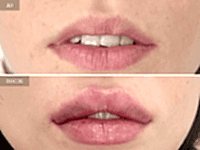 До/После фото 2 - 