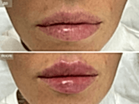 До/После фото 2 - 