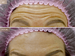 Фотогалерея фото 2 - 