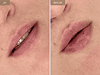 До/После фото 2 - 