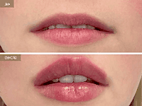 До/После фото 2 - 