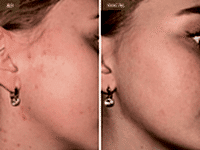 До/После фото 2 - 