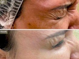 Фотогалерея фото 2 - 