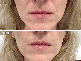 Фотогалерея фото 2 - 