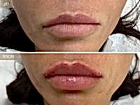 До/После фото 2 - 