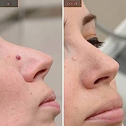 Фотогалерея фото 4 -