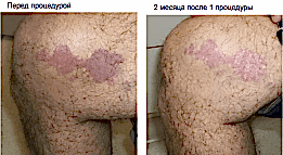 Фотогалерея фото 4 -