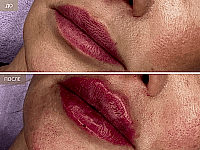 До/После фото 2 - 