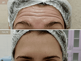 Фотогалерея фото 2 - 