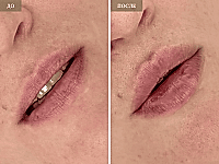 До/После фото 2 - 