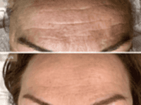 До/После фото 2 - 