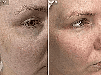 До/После фото 2 - 