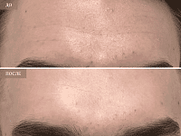 До/После фото 2 - 