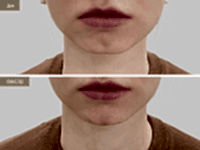 До/После фото 2 - 