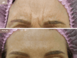 Фотогалерея фото 2 - 