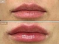 До/После фото 2 - 