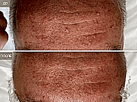 До/После фото 1 - 