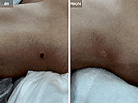 До/После фото 2 - 