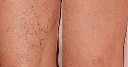 Фотогалерея фото 4 -